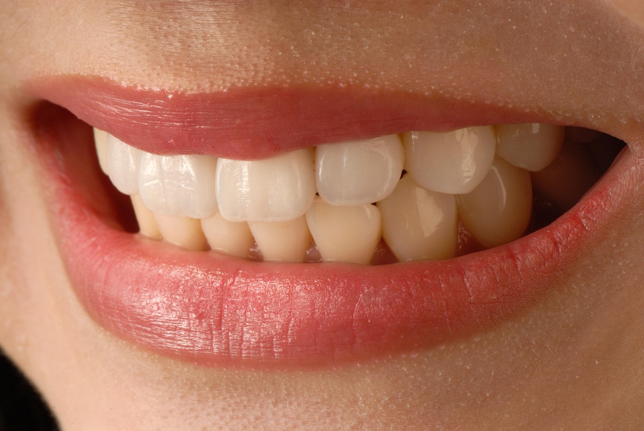 veneer tech